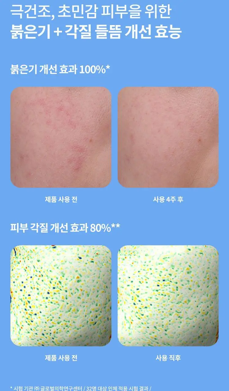 [꾸덕보습] 라네즈 워터뱅크 인텐시브 크림 45ml 기획 (+10ml*2ea) 상세페이지 6